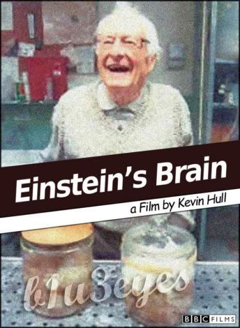 Brain Of Einstein