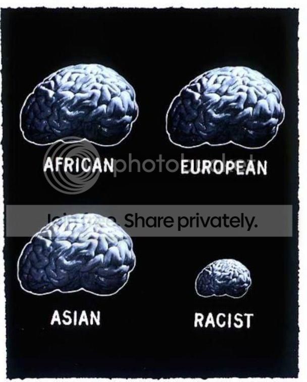 Brain Zps84a13821